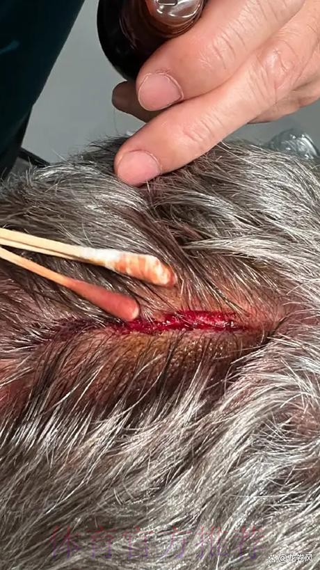 记者:安帅首选是留在皇马 但双方还没开始谈续约 记者:安帅首选是留在皇马 但双方还没开始谈续约